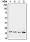 Claudin 1 antibody, MBS821600, MyBioSource, Western Blot image 