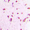 Myocyte Enhancer Factor 2C antibody, LS-C356188, Lifespan Biosciences, Immunohistochemistry frozen image 