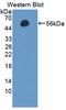 Selectin L antibody, LS-C683970, Lifespan Biosciences, Western Blot image 