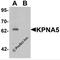 Karyopherin Subunit Alpha 5 antibody, 6655, ProSci, Western Blot image 
