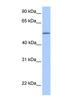 Zinc Finger Protein 708 antibody, NBP1-79392, Novus Biologicals, Western Blot image 