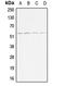 Activin A Receptor Type 1B antibody, LS-B13175, Lifespan Biosciences, Western Blot image 