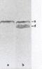 Smoothelin antibody, ab8969, Abcam, Western Blot image 