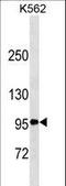 TNF Receptor Superfamily Member 8 antibody, LS-C157236, Lifespan Biosciences, Western Blot image 