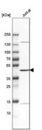 V-set and immunoglobulin domain-containing protein 4 antibody, NBP1-86843, Novus Biologicals, Western Blot image 