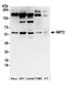 N-Myristoyltransferase 2 antibody, A304-359A, Bethyl Labs, Western Blot image 