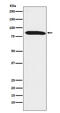 Dynein Axonemal Intermediate Chain 1 antibody, M07656-1, Boster Biological Technology, Western Blot image 