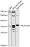 Major Histocompatibility Complex, Class II, DO Beta antibody, 14-338, ProSci, Western Blot image 