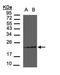 Receptor Activity Modifying Protein 2 antibody, orb73679, Biorbyt, Western Blot image 