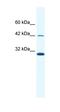 Apolipoprotein B MRNA Editing Enzyme Catalytic Subunit 3G antibody, orb329731, Biorbyt, Western Blot image 