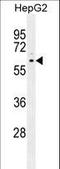 Peroxisome Proliferator Activated Receptor Delta antibody, LS-C163889, Lifespan Biosciences, Western Blot image 