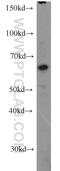 N-Myristoyltransferase 1 antibody, 11546-1-AP, Proteintech Group, Western Blot image 