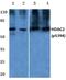 Histone Deacetylase 2 antibody, A00325S394, Boster Biological Technology, Western Blot image 