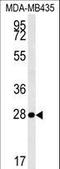 Mitochondrial RRNA Methyltransferase 1 antibody, LS-C164627, Lifespan Biosciences, Western Blot image 