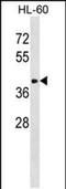 Alpha-2,8-sialyltransferase 8F antibody, PA5-48789, Invitrogen Antibodies, Western Blot image 