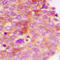 Insulin Receptor Substrate 1 antibody, LS-C352386, Lifespan Biosciences, Immunohistochemistry paraffin image 