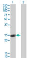 Catechol-O-Methyltransferase antibody, LS-C196950, Lifespan Biosciences, Western Blot image 