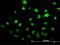 SUMO1 Activating Enzyme Subunit 1 antibody, H00010055-M01, Novus Biologicals, Immunocytochemistry image 