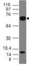 Interleukin 1 Receptor Like 2 antibody, M09203, Boster Biological Technology, Western Blot image 
