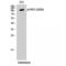 Serine/threonine-protein kinase D1 antibody, LS-C381319, Lifespan Biosciences, Western Blot image 