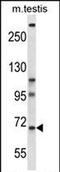 Poly(A) Specific Ribonuclease Subunit PAN3 antibody, PA5-71860, Invitrogen Antibodies, Western Blot image 