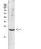 Interleukin 31 antibody, STJ98951, St John