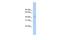 TRNA Methyltransferase 10C, Mitochondrial RNase P Subunit antibody, GTX47292, GeneTex, Western Blot image 