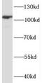 Protein Phosphatase 1 Regulatory Subunit 12B antibody, FNab06700, FineTest, Western Blot image 