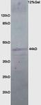 Decaprenyl Diphosphate Synthase Subunit 2 antibody, orb158131, Biorbyt, Western Blot image 