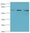 DEAD-Box Helicase 5 antibody, MBS1494949, MyBioSource, Western Blot image 