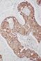 TNF Alpha Induced Protein 8 Like 3 antibody, PA2257, Boster Biological Technology, Immunohistochemistry paraffin image 