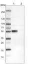 RNA Binding Motif Single Stranded Interacting Protein 3 antibody, NBP1-89497, Novus Biologicals, Western Blot image 