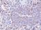 Serine/threonine-protein phosphatase PP1-gamma catalytic subunit antibody, GTX105618, GeneTex, Immunohistochemistry paraffin image 