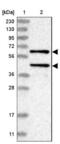 Protein Phosphatase, Mg2+/Mn2+ Dependent 1A antibody, NBP2-13796, Novus Biologicals, Western Blot image 