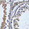 Inositol monophosphatase 1 antibody, 22-174, ProSci, Immunohistochemistry frozen image 