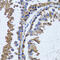 Inositol Monophosphatase 1 antibody, 22-174, ProSci, Immunohistochemistry frozen image 