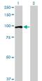 OCRL Inositol Polyphosphate-5-Phosphatase antibody, H00004952-D01P, Novus Biologicals, Western Blot image 