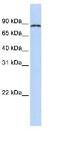 Cytoplasmic Polyadenylation Element Binding Protein 4 antibody, ab83009, Abcam, Western Blot image 