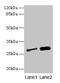 Insulin Like Growth Factor Binding Protein 1 antibody, CSB-PA08419A0Rb, Cusabio, Western Blot image 