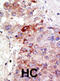 Protein Inhibitor Of Activated STAT 1 antibody, abx026807, Abbexa, Immunohistochemistry frozen image 