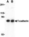 Cadherin 13 antibody, GTX85891, GeneTex, Western Blot image 
