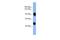 Adaptor Related Protein Complex 1 Subunit Beta 1 antibody, A08641, Boster Biological Technology, Western Blot image 