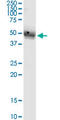 ST8 Alpha-N-Acetyl-Neuraminide Alpha-2,8-Sialyltransferase 4 antibody, LS-C198509, Lifespan Biosciences, Western Blot image 