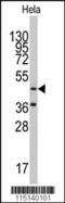 AsnRS antibody, 63-015, ProSci, Western Blot image 