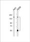 ADAM Metallopeptidase With Thrombospondin Type 1 Motif 17 antibody, PA5-49469, Invitrogen Antibodies, Western Blot image 