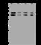 Prolyl 4-Hydroxylase Subunit Alpha 2 antibody, 200873-T46, Sino Biological, Western Blot image 