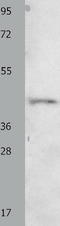 Neurotensin Receptor 1 antibody, TA322996, Origene, Western Blot image 