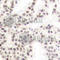 ETS Transcription Factor ELK1 antibody, AP0346, ABclonal Technology, Immunohistochemistry paraffin image 