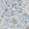 Alpha-1-antitrypsin antibody, LS-C331209, Lifespan Biosciences, Immunohistochemistry paraffin image 