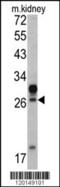 Homeobox A5 antibody, 62-408, ProSci, Western Blot image 